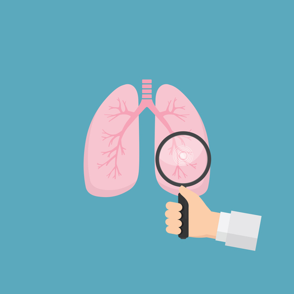 lung cancer screening